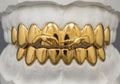 Custom Kish-Kush Grillz